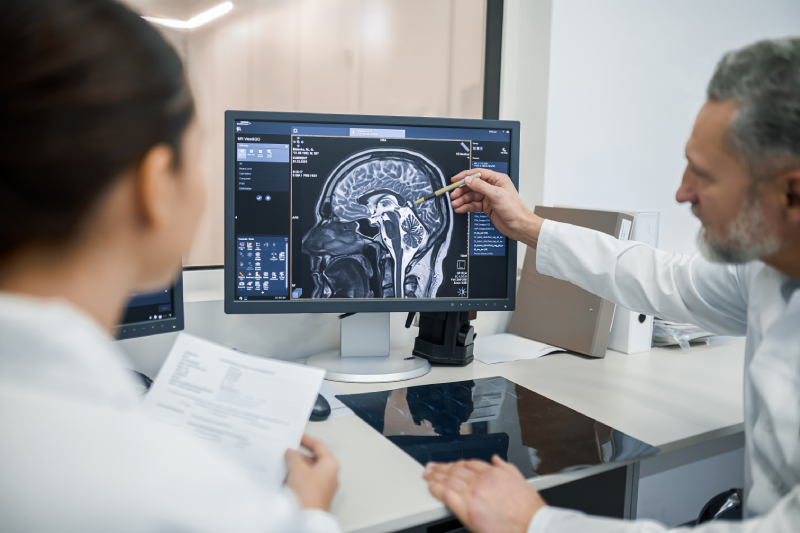 sao-leopoldo-mandic-faculdade-de-medicina-pos-graduaçao-medica-o-que-e-epilepsia-e-como-tratar